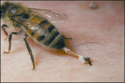 Falsehood Invest Look back Apicultura de la A la Z - Înţepăturile de albine şi viespi